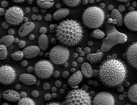 Image:Misc pollen.jpg